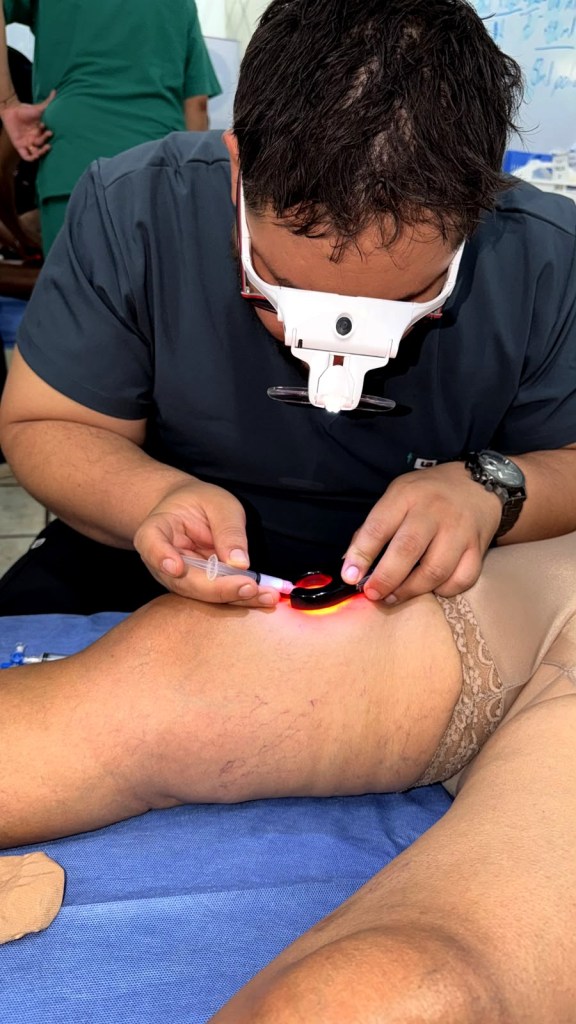Ablación endovenosa con láser por el Dr. Marvin Lazo