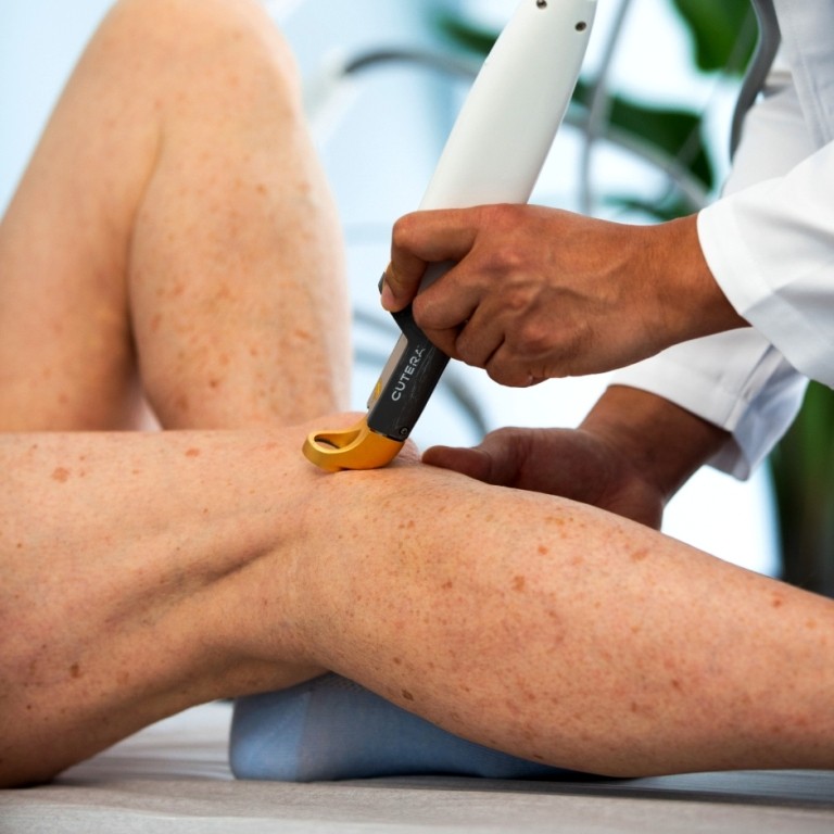 Evaluación de dolor y pesadez de piernas por el Dr. Marvin Lazo
